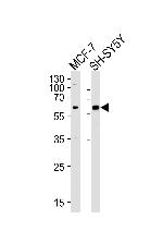 ZBTB22 Polyclonal Antibody