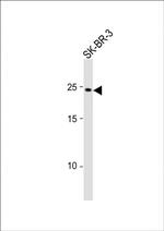 RAB32 Polyclonal Antibody