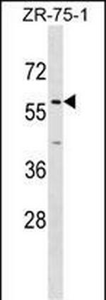 ZNF10 Polyclonal Antibody
