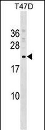 COMMD9 Polyclonal Antibody