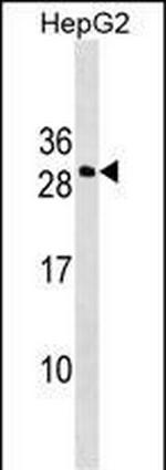 DDIT4L Polyclonal Antibody