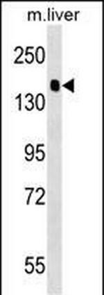 PPFIA2 Polyclonal Antibody