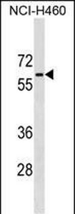 PGM5 Polyclonal Antibody