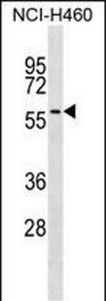 UGT2A3 Polyclonal Antibody