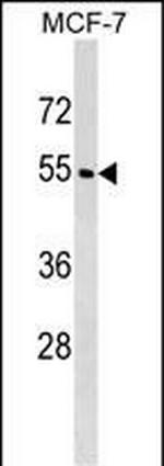 WDR20 Polyclonal Antibody