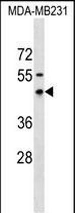 RNFT1 Polyclonal Antibody