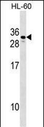hCG beta-1 Polyclonal Antibody