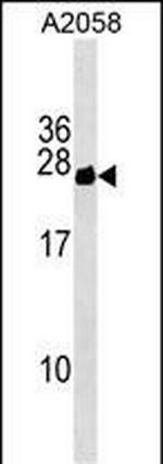 CYorf15B Polyclonal Antibody