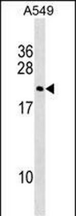 DUX3 Polyclonal Antibody