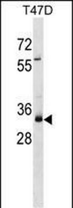 MYEOV Polyclonal Antibody
