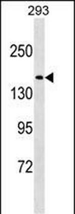 NUP188 Polyclonal Antibody