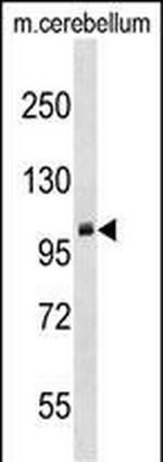PRMT9 Antibody in Western Blot (WB)
