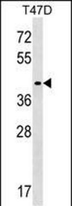 MMADHC Polyclonal Antibody