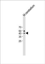 QPCTL Polyclonal Antibody