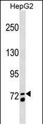 MS4A14 Antibody in Western Blot (WB)