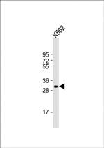NKX6-2 Polyclonal Antibody