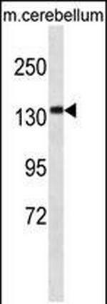 CAMSAP3 Polyclonal Antibody