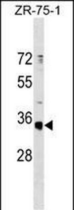 OR51G1 Polyclonal Antibody