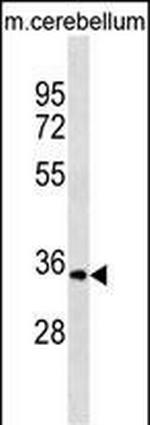 UCK1 Polyclonal Antibody
