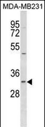 FAHD2B Antibody in Western Blot (WB)