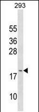 GAGE3 Polyclonal Antibody