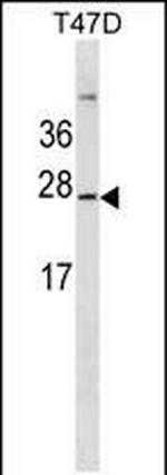 GKN3P Polyclonal Antibody