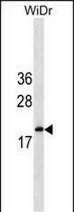 IFNA5 Polyclonal Antibody