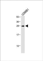 IGLL5 Polyclonal Antibody