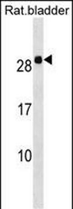 HOXB7 Polyclonal Antibody