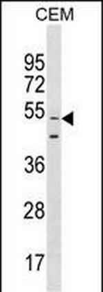 GOLGA6L9 Antibody in Western Blot (WB)
