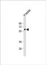 GMCL1L Polyclonal Antibody