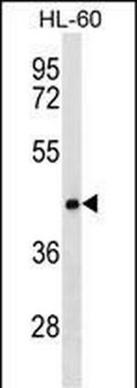 CLN8 Polyclonal Antibody