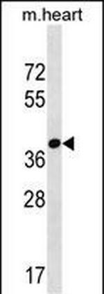 FBXO22 Polyclonal Antibody