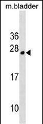 TPD52L1 Polyclonal Antibody