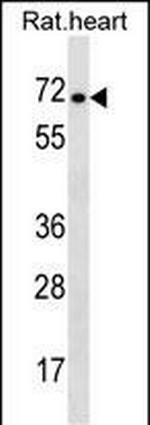 STRA6 Polyclonal Antibody