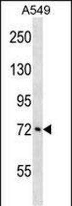ATXN1L Polyclonal Antibody