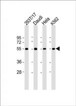 B7-H6 Polyclonal Antibody