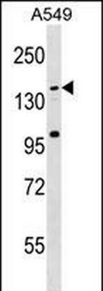 CCDC144C Antibody in Western Blot (WB)