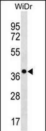 CLCA3P Antibody in Western Blot (WB)