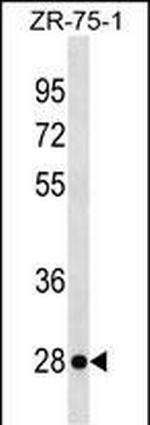 KLRF2 Antibody in Western Blot (WB)
