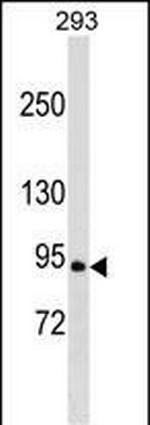 RALGDS Antibody in Western Blot (WB)