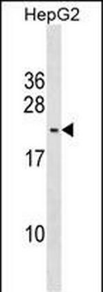 PMS2L5 Polyclonal Antibody