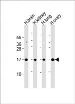 PPIAL4A Antibody in Western Blot (WB)