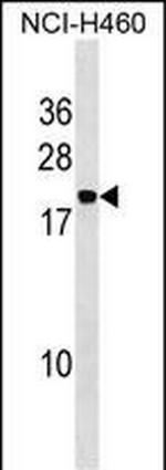 PPIAL4A Antibody in Western Blot (WB)