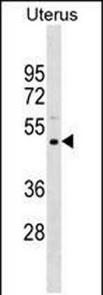 PRAMEF11 Antibody in Western Blot (WB)
