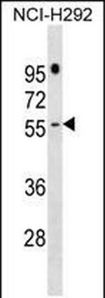 PRAMEF16 Polyclonal Antibody