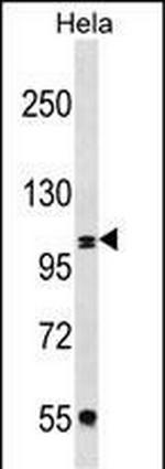 COPB2 Antibody in Western Blot (WB)