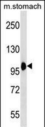 COPB2 Antibody in Western Blot (WB)