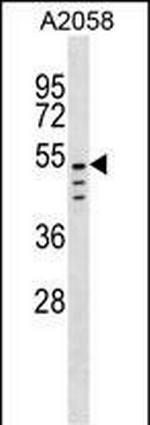 CLEC18C Polyclonal Antibody