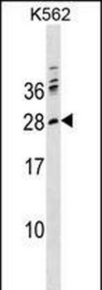 PTCRA Polyclonal Antibody